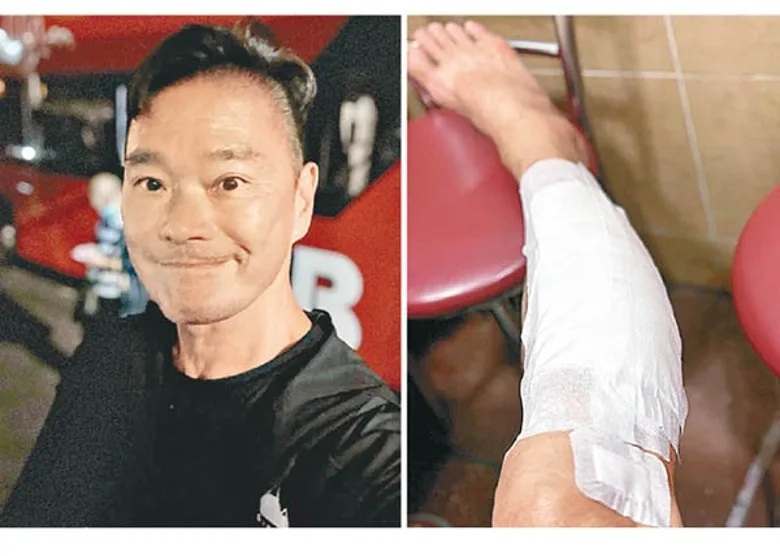 鄧達智回家途中不幸受傷。.jpg