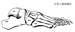 normal foot4-1-2-1(1-250).jpg