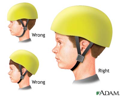 bicycle-helmet-proper-usage.jpg