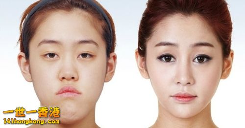 korean_plastic_surgery_01.jpg