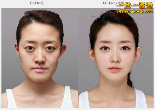 korean_plastic_surgery_02.jpg