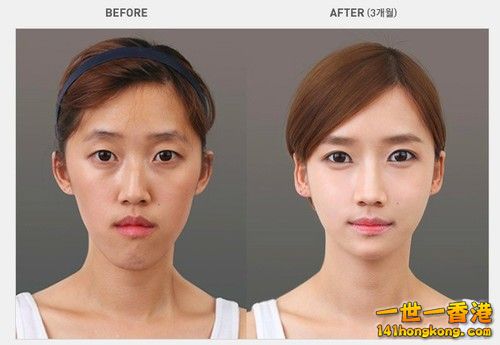 korean_plastic_surgery_03.jpg