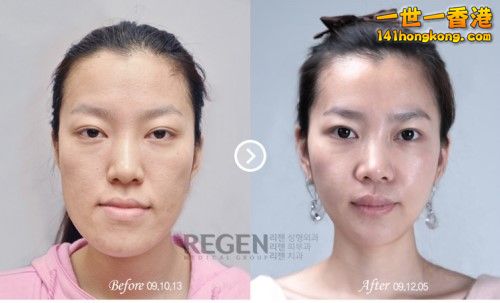 korean_plastic_surgery_05.jpg