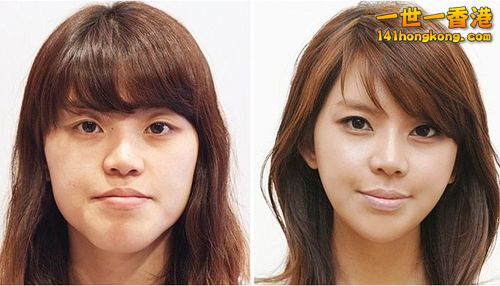 korean_plastic_surgery_11.jpg
