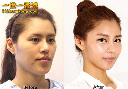 korean_plastic_surgery_13.jpg