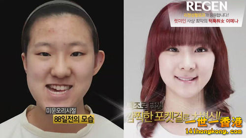korean_plastic_surgery_23.jpg