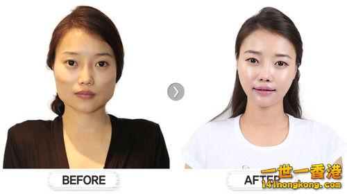 korean_plastic_surgery_29.jpg