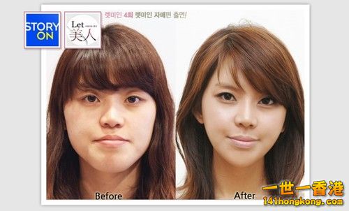 korean_plastic_surgery_31.jpg