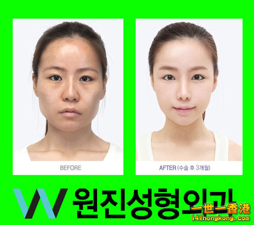 korean_plastic_surgery_33.jpg