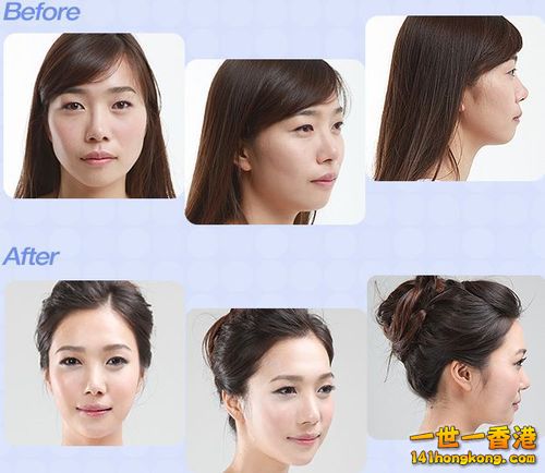 korean_plastic_surgery_42.jpg