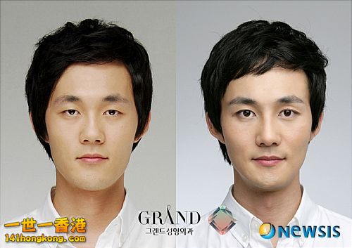 korean_plastic_surgery_43.jpg