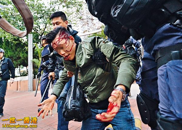 疑塗「血漿」博同情「傷者」傳正考輔警.jpg
