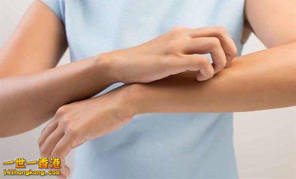 濕疹好痕點算？.jpg