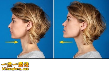 頭痛8.jpg