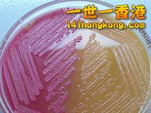 220px-MacConkey_agar_with_LF_and_LF_colonies.jpg