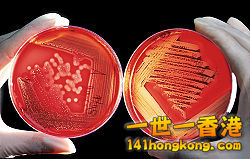 250px-Agarplate_redbloodcells_edit.jpg