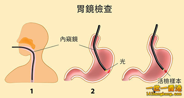 stomach3-600x320.jpg