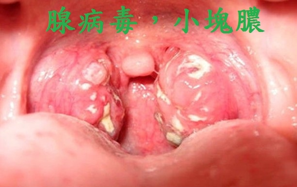 A65C41DA-E808-46C6-98D0-AB13DE2E69C2.jpeg