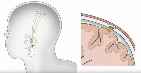 Sb6BfWeLCBZWIjzLIdFnnENXf6CV8jmJvwHQ2r8B0No?v=w480