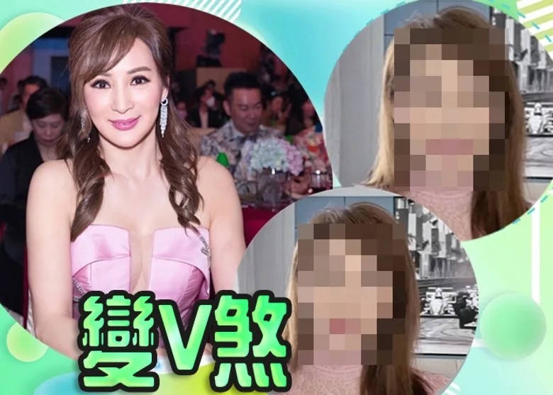 1 羅霖內地拍片出事走晒樣 網民取笑：下巴尖到拮死人.jpg