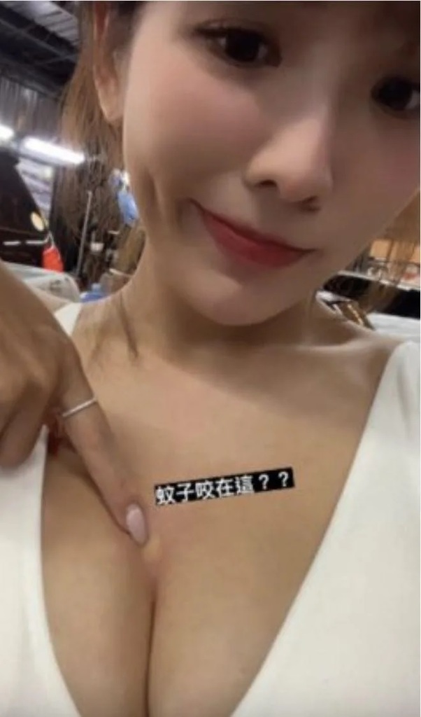 2 壯壯被蚊子叮了一包。（圖／壯壯IG）.jpg