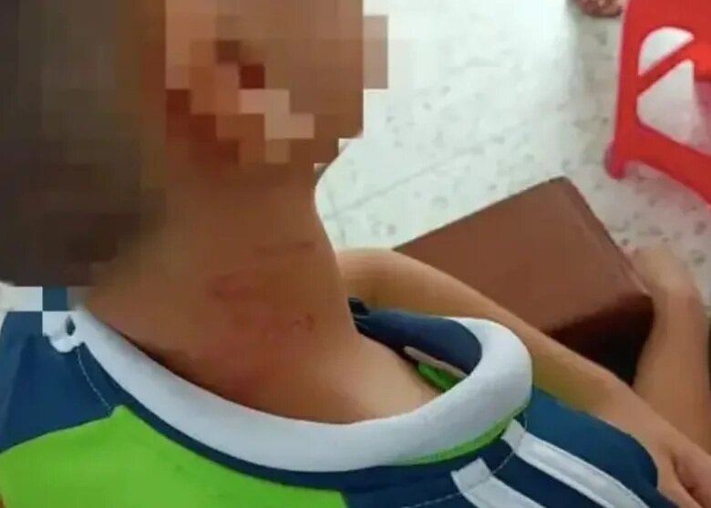 男童未戴紅領巾被校長掐頸昏厥 教育局調查.jpg