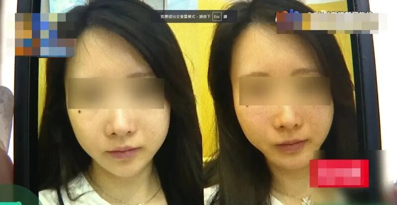 杭州女投訴花12萬整容被說老了10年 網民錯重點「主管都這樣還敢消費」.jpg