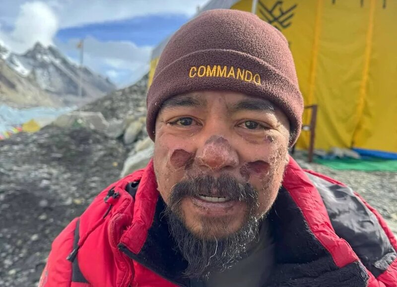 4 菲律賓的 45 歲男登山者 Philipp II Santiago.jpg