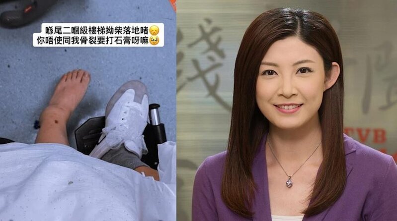 1 前「新聞之花」張文采跌斷腳 骨裂打石膏需坐輪椅 曾戀「負評王」羅鈞滿自嘲太蠢.jpg