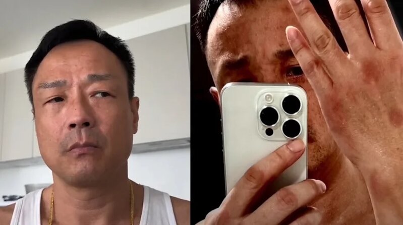 2 王喜報稱去年曾兩度被迷姦，更展示當時用手機拍下的傷勢。.jpg