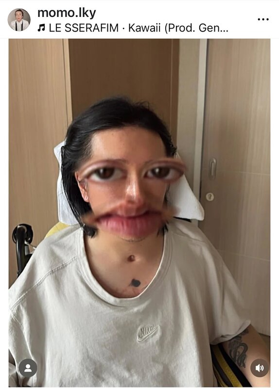 2 阿Mo於墮屏意外3年後首度發近照.jpg