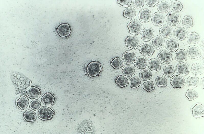 3 原蟲會黏附在角膜表面，若角膜上皮細胞出現傷口，原蟲便會鑽入角膜內部。.jpg