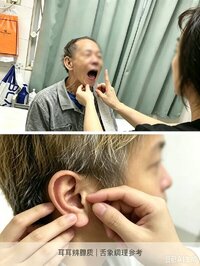 本來調理早泄，師傅透過舌診耳診，提前發現我膽囊隱患