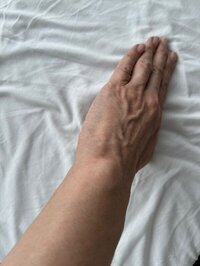 坐骨神经疼，腰疼，肩颈疼。这些问题都治好了